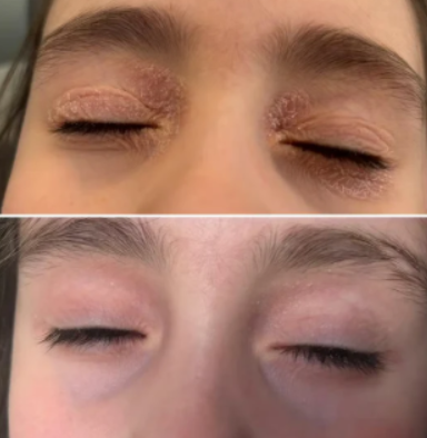 Chloe R., Vancouver BC