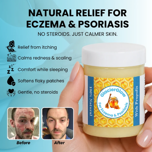 Repair Balm For Eczema & Psoriasis