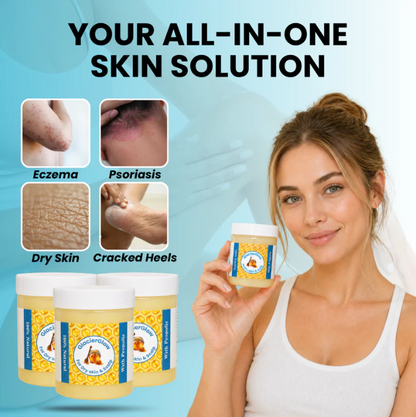 Repair Balm For Eczema & Psoriasis