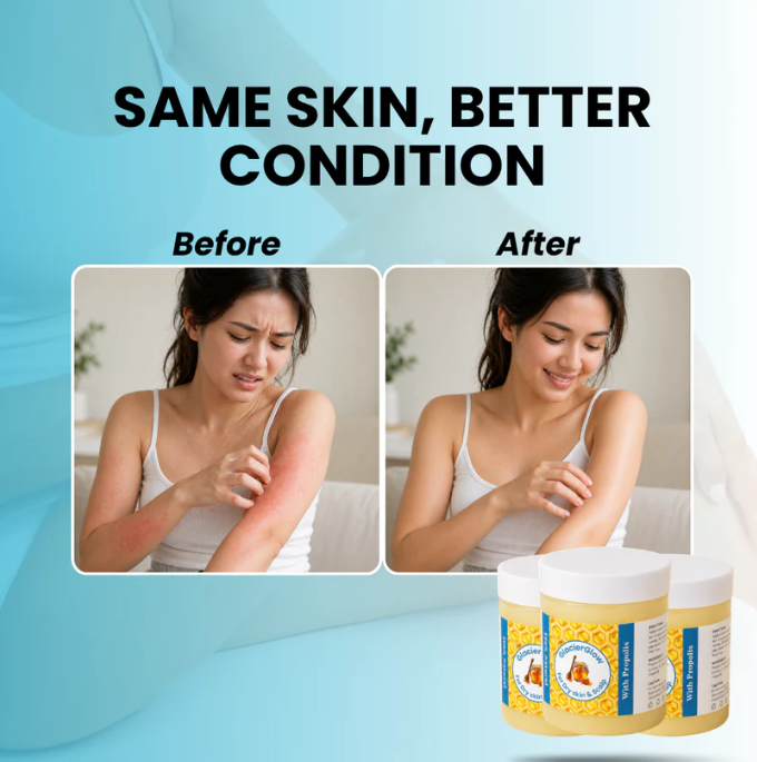 Repair Balm For Eczema & Psoriasis