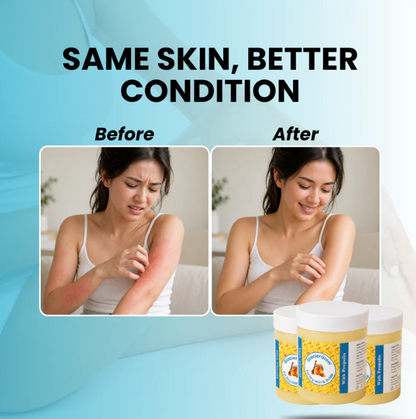 Repair Balm For Eczema & Psoriasis